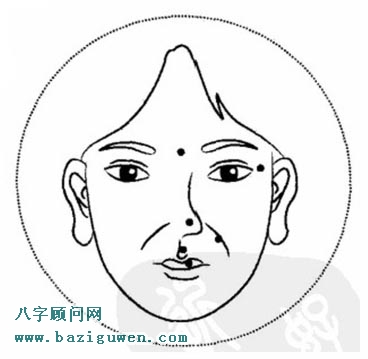 不同部位的面部痣